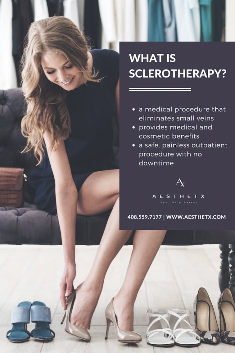Advertisement for sclerotherapy