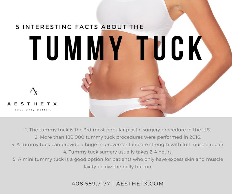 Facts about tummy tucks
