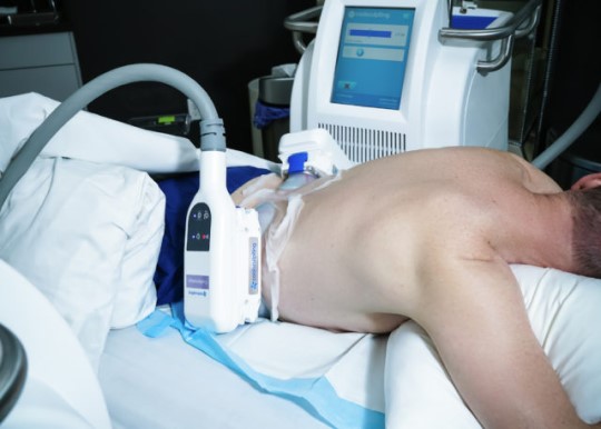 Person going through CoolSculpting treatment