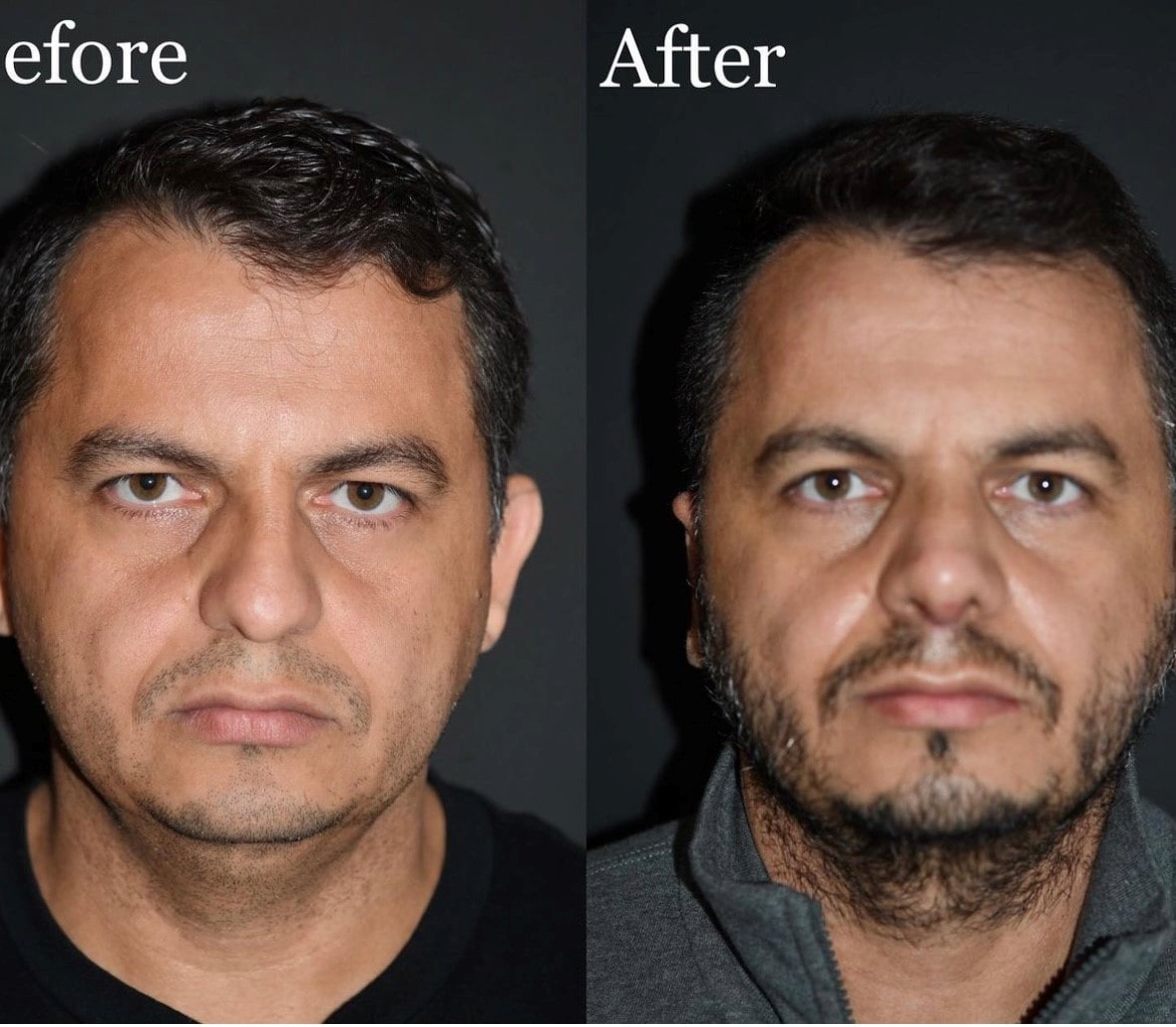 plastic surgery patient results