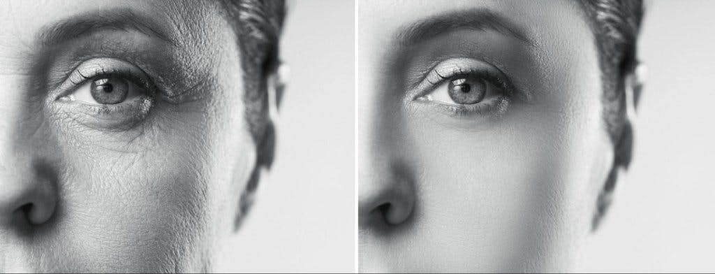 woman before and after