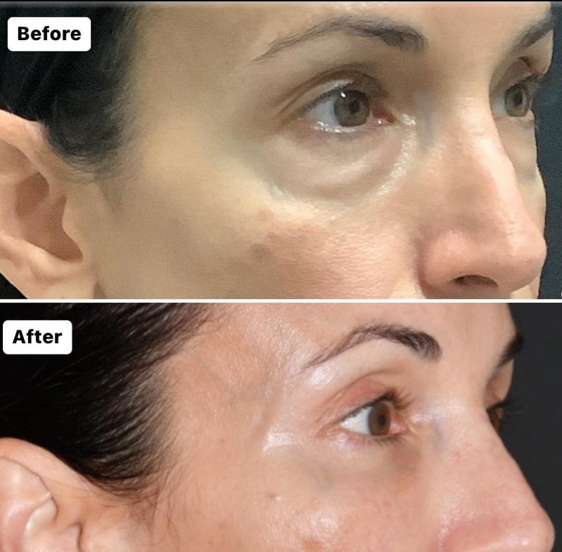 patient results