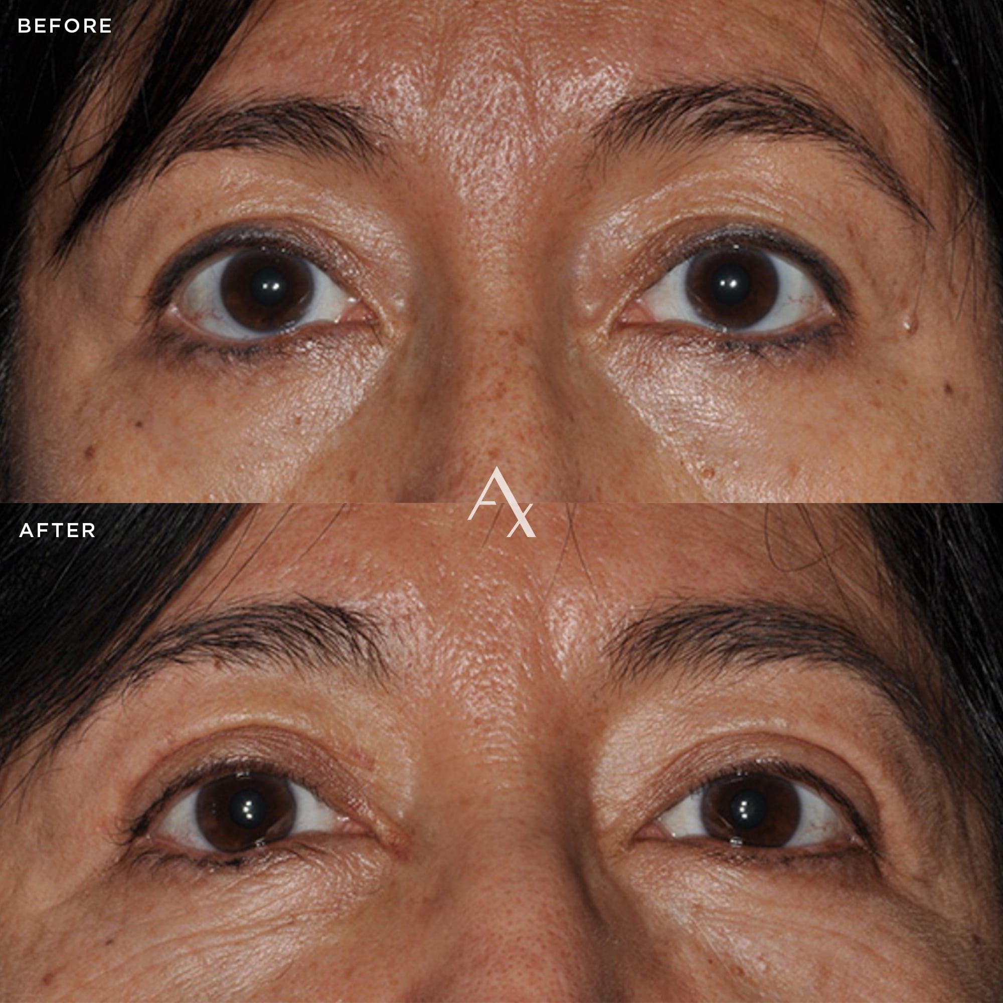 patient results