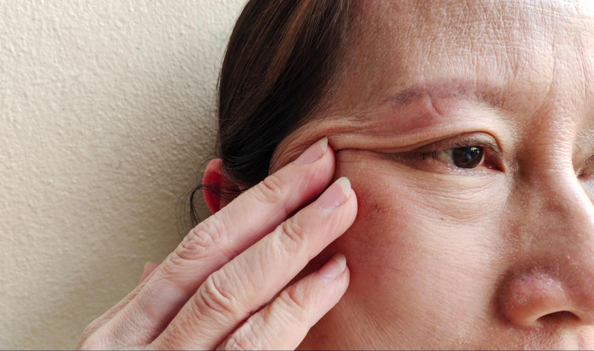 person touching their face