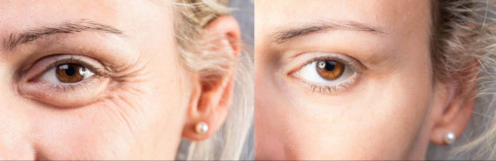 patient results