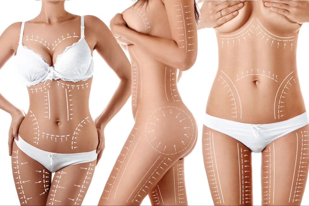 women's bodies with outlines on them
