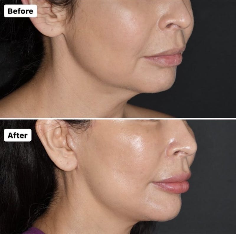 patient results