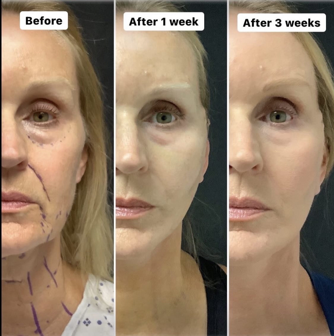 patient results