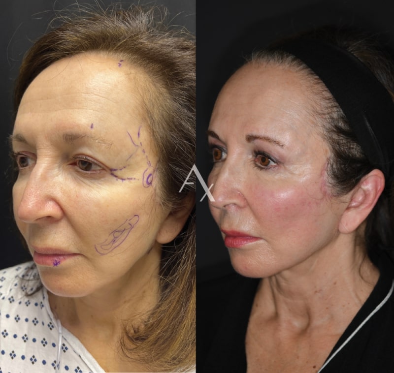 patient results