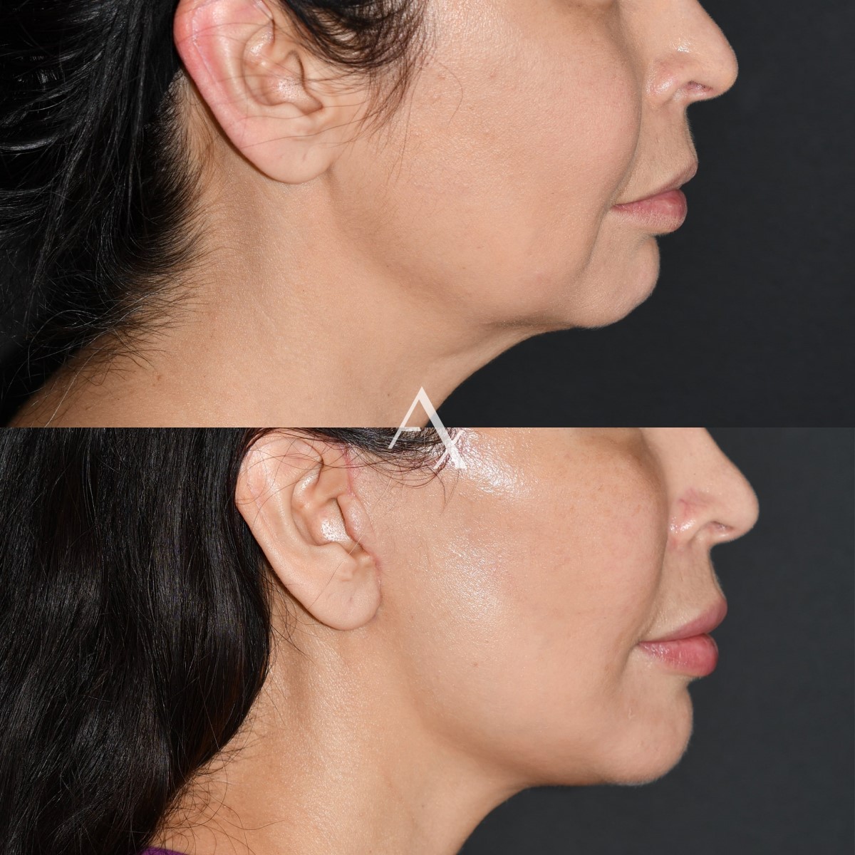 patient results