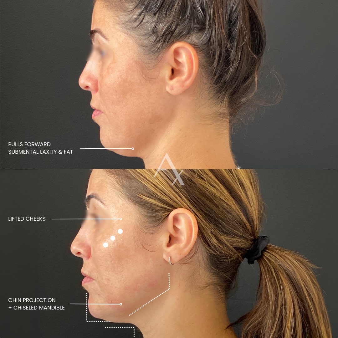patient results
