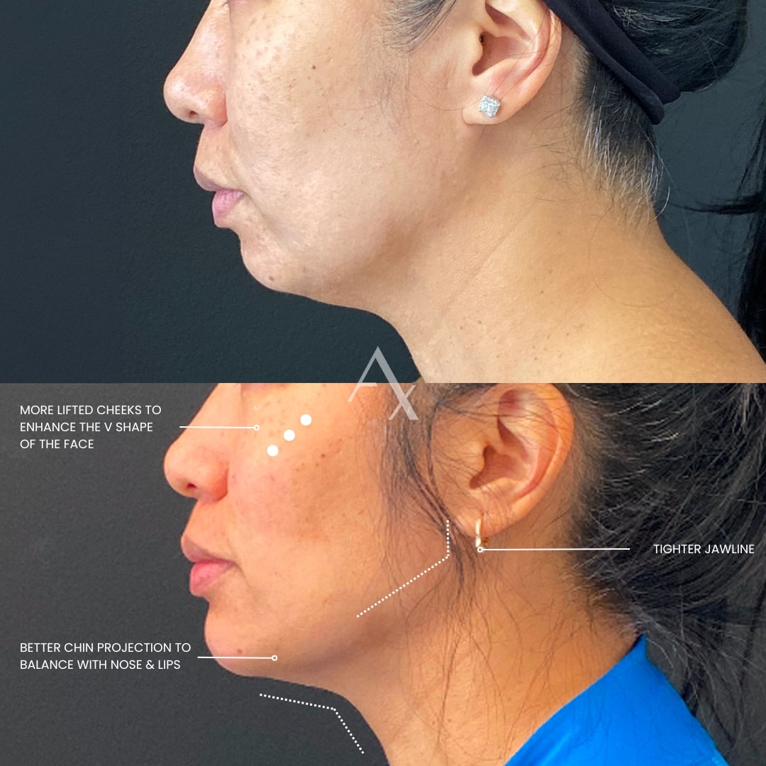 patient results