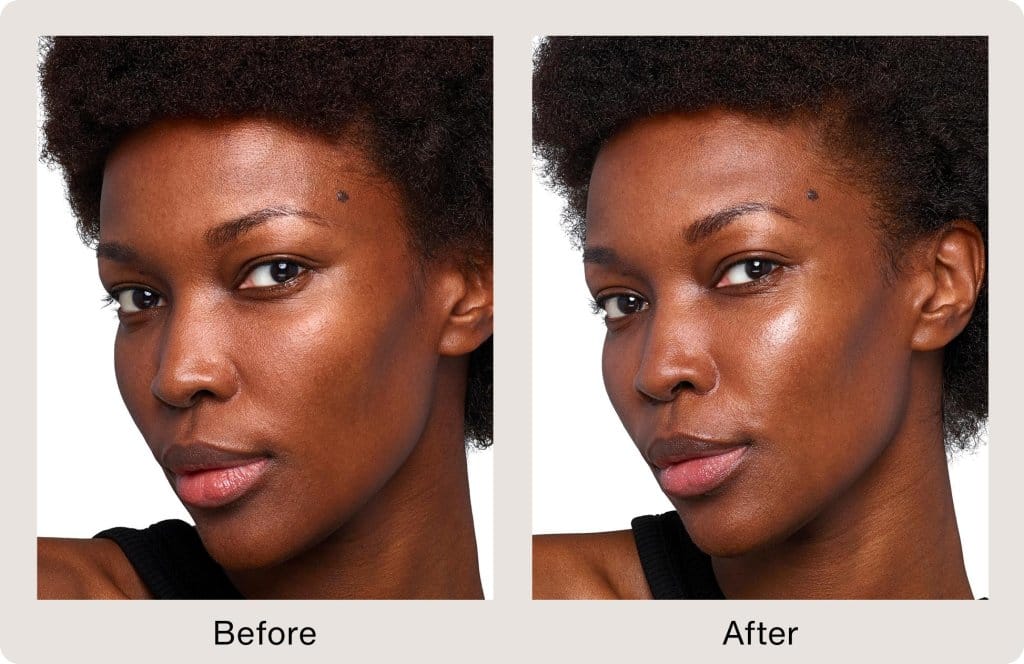 SKINVIVE™ by JUVÉDERM®