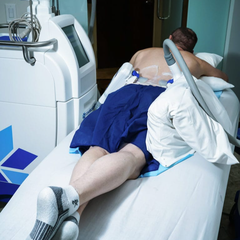 vaser shape procedure