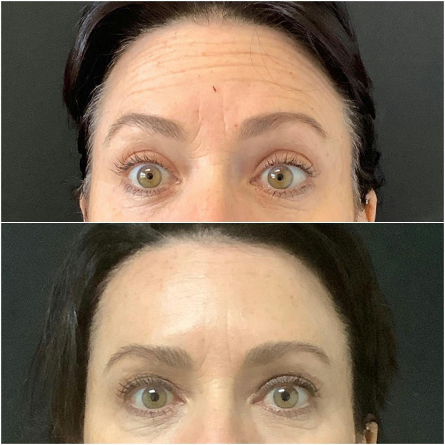 Before and after photo by Gigi, P.A. on Instagram