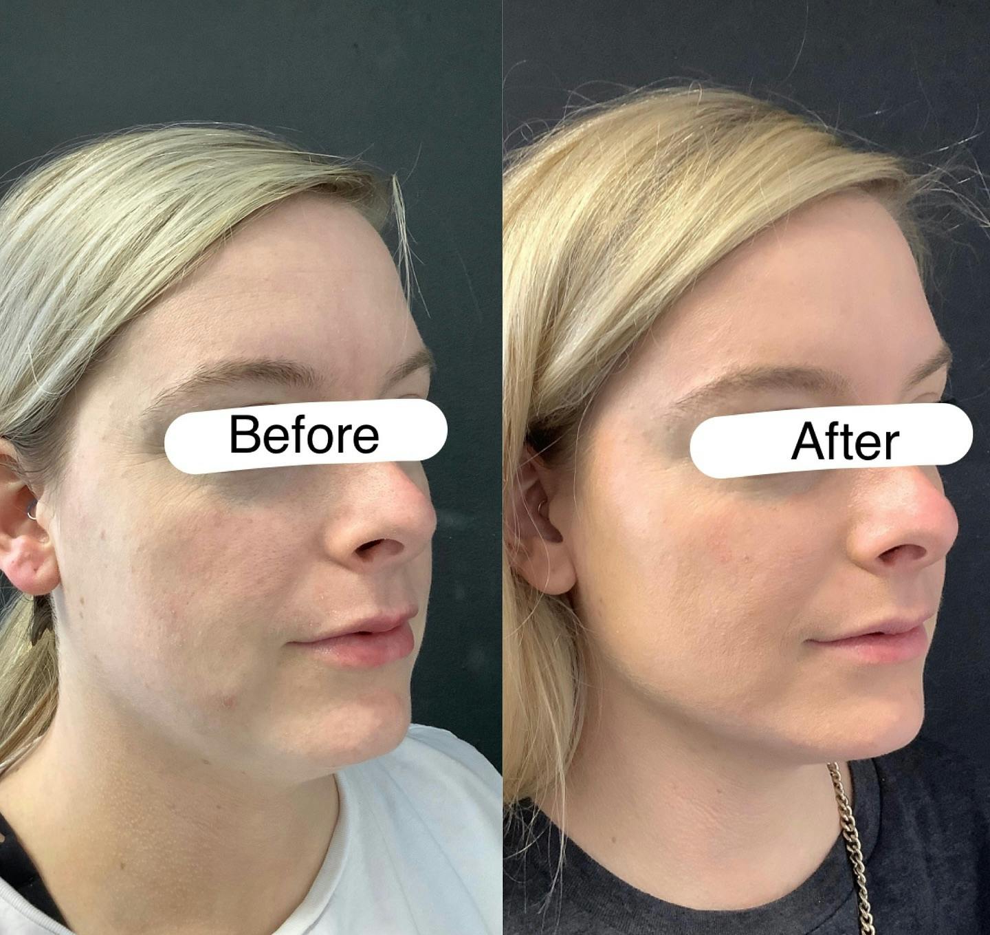 Before and after photo by Gigi, P.A. on Instagram