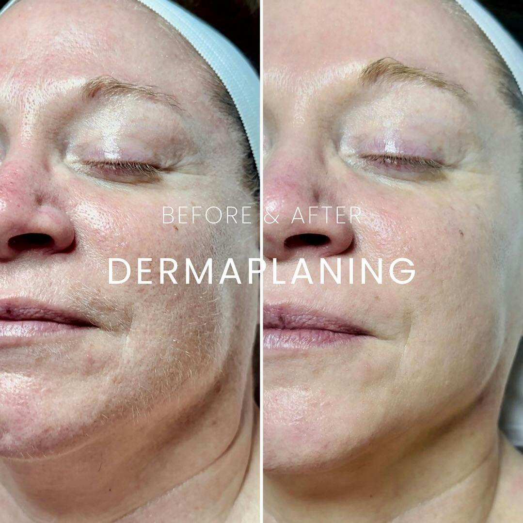 Before and after photo by Kristin, L.E. on Instagram