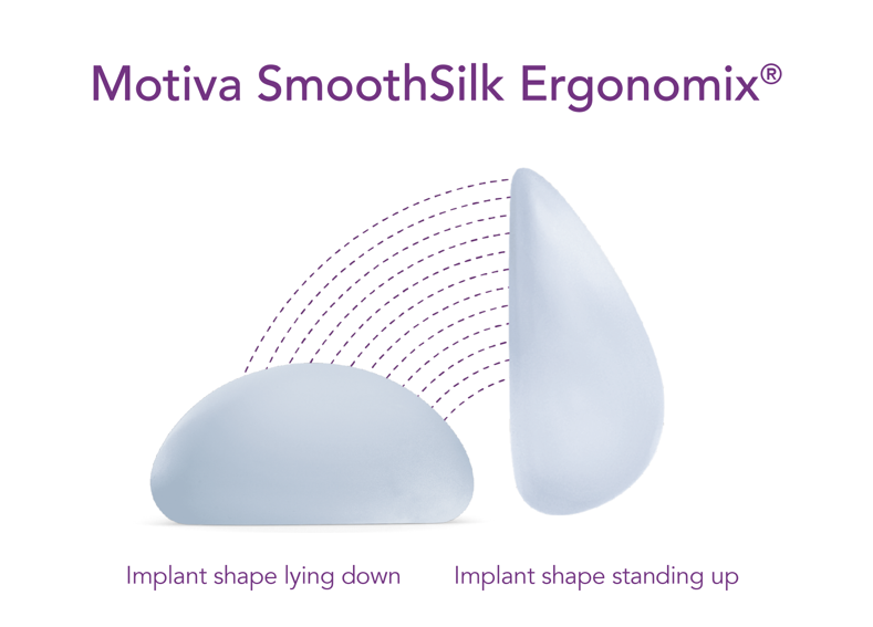 motiva infro graphic for SmoothSilk ergonomix