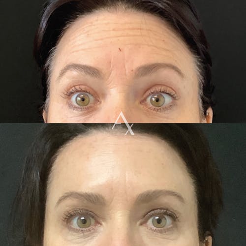 Aesthetx.com, real patient case result before and after image