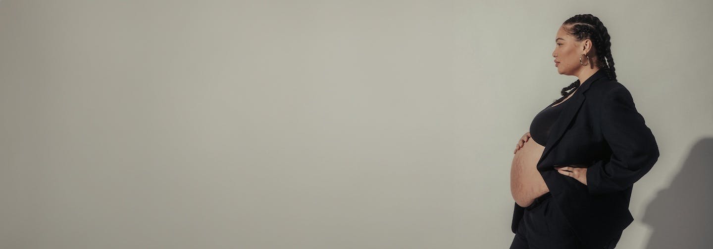 Pregnant woman with stretch marks, hand perched on her stomach