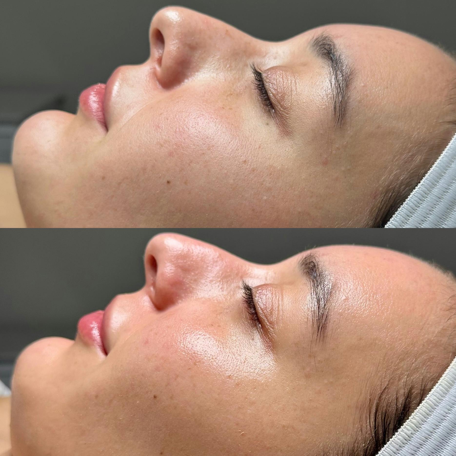 procedure