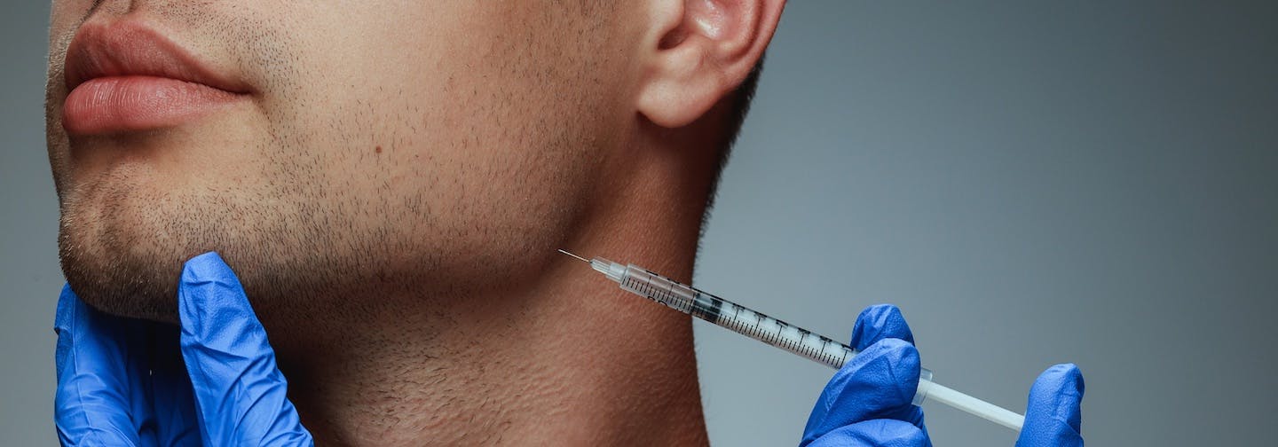 stock image of masseter botox being performed by gloved hands