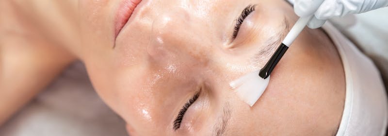 aesthetician applies chemical peel ingredients to female face