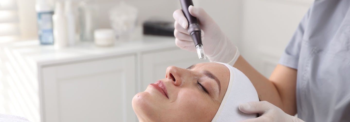 female patient about to undergo microneedling with PRP