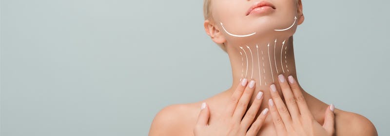 graphic illustration of smoothed neck and refined jawline