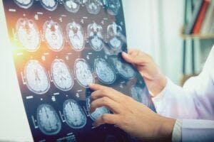brain scans