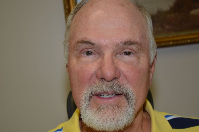 Upper Blepharoplasty Before & After Gallery - Patient 279789 - Image 2