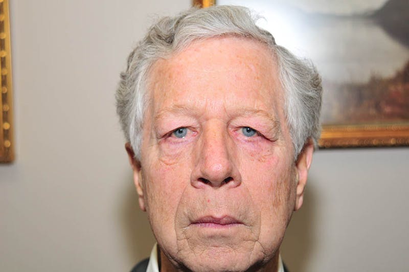 Upper Blepharoplasty Before & After Gallery - Patient 219566 - Image 1