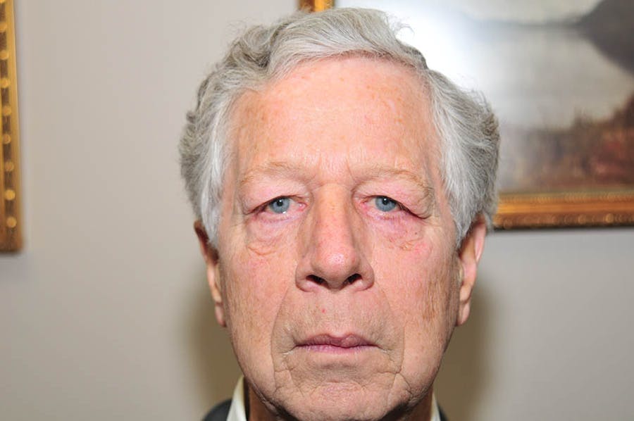 Upper Blepharoplasty Before & After Gallery - Patient 219566 - Image 1