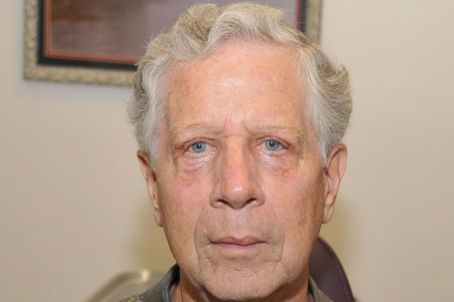 Upper Blepharoplasty Before & After Gallery - Patient 219566 - Image 2