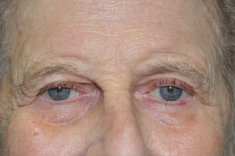 Facial Surgery Options Before & After Gallery - Patient 325456 - Image 1