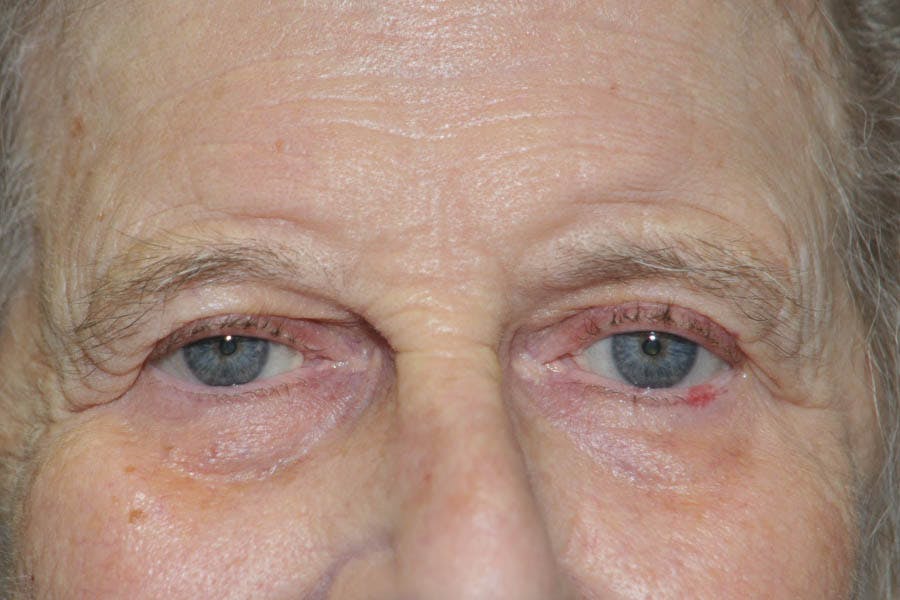 Cosmetic Facial Surgery Options Before & After Gallery - Patient 325456 - Image 1