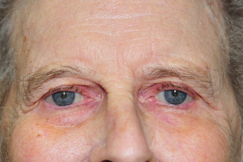 Facial Surgery Options Before & After Gallery - Patient 325456 - Image 2
