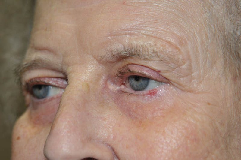 Facial Surgery Options Before & After Gallery - Patient 325456 - Image 3
