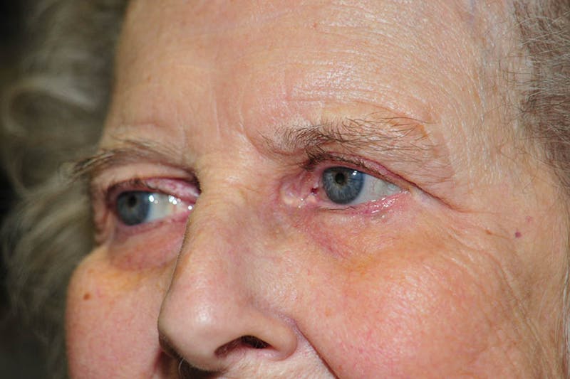 Facial Surgery Options Before & After Gallery - Patient 325456 - Image 4