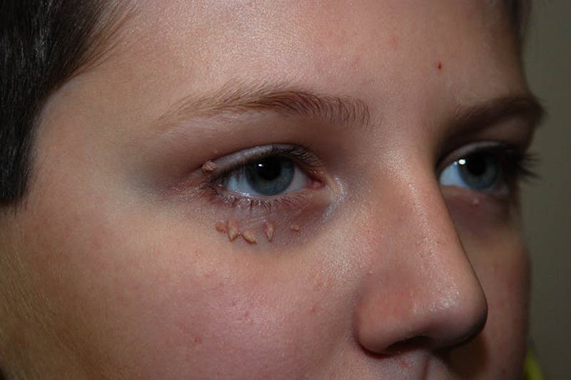 Facial Surgery Options Before & After Gallery - Patient 344049 - Image 1