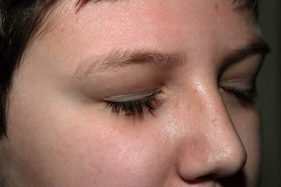 Cosmetic Facial Surgery Options Before & After Gallery - Patient 344049 - Image 2