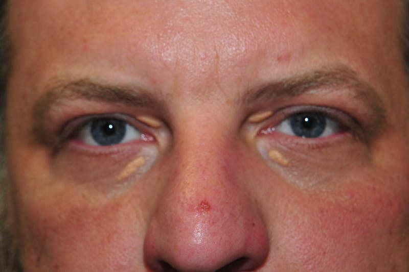 Facial Surgery Options Before & After Gallery - Patient 232449 - Image 1