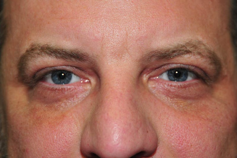 Facial Surgery Options Before & After Gallery - Patient 232449 - Image 2