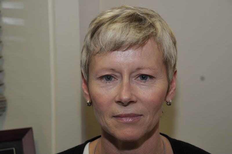 Chemical Peels Before & After Gallery - Patient 307090 - Image 1