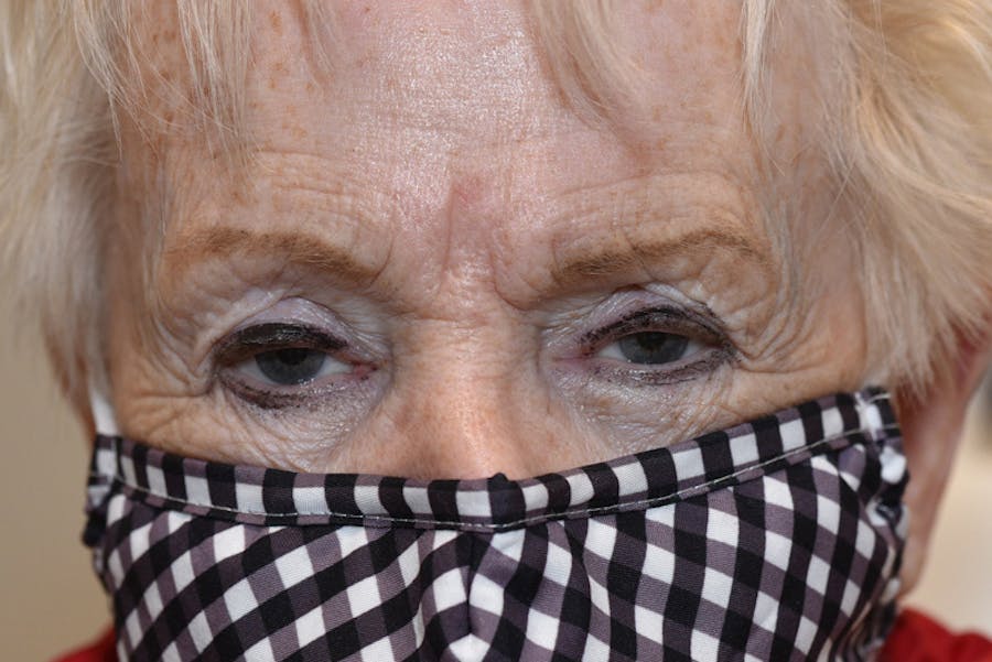 Ptosis Repair Before & After Gallery - Patient 254115 - Image 1