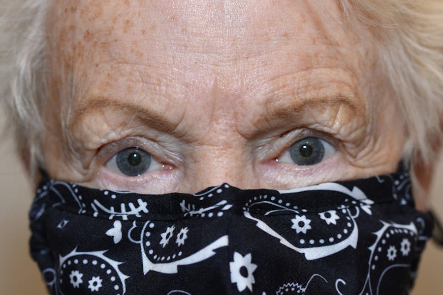 Ptosis Repair Before & After Gallery - Patient 254115 - Image 2