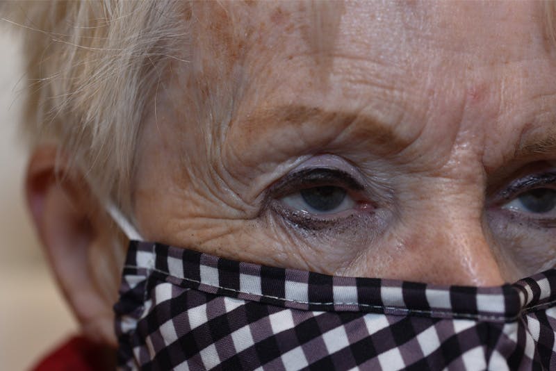 Ptosis Repair Before & After Gallery - Patient 254115 - Image 3