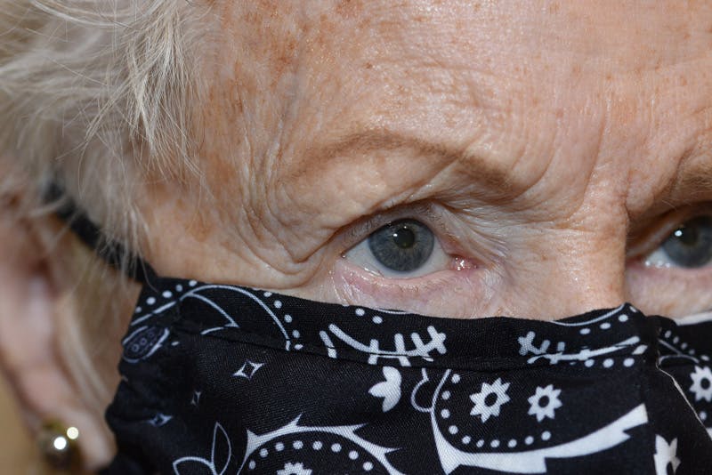 Ptosis Repair Before & After Gallery - Patient 254115 - Image 4