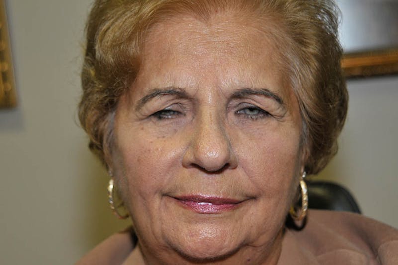 Ptosis Repair Before & After Gallery - Patient 375380 - Image 1