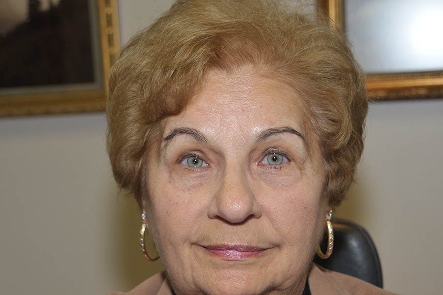 Ptosis Repair Before & After Gallery - Patient 375380 - Image 2